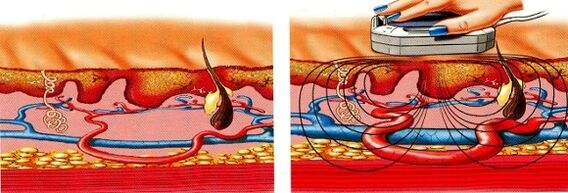 if your legs go numb